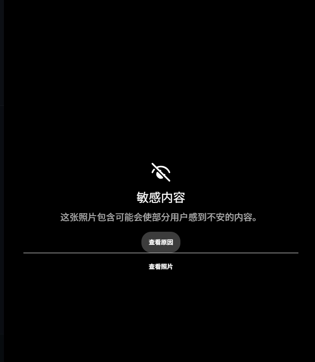 范德彪小拇指脱臼刺穿皮肤 伤情图被ESPN标记敏感 范德彪小拇指脱臼刺穿皮肤 伤情图被ESPN标记敏感